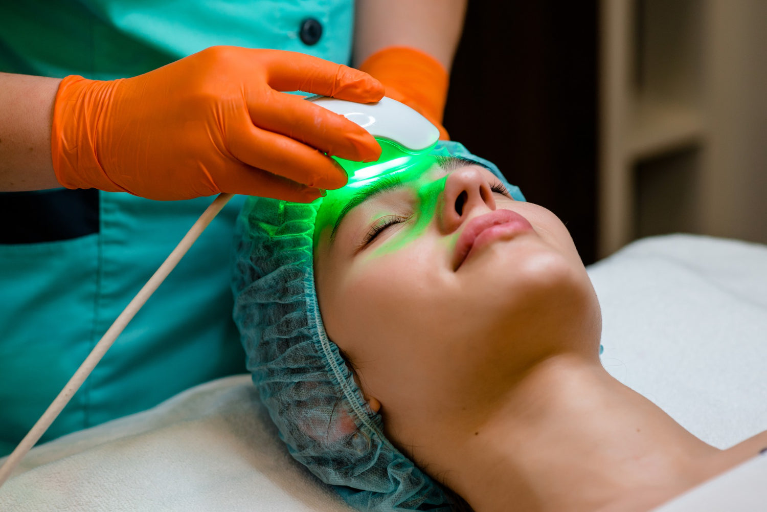 Carbon Laser Facial