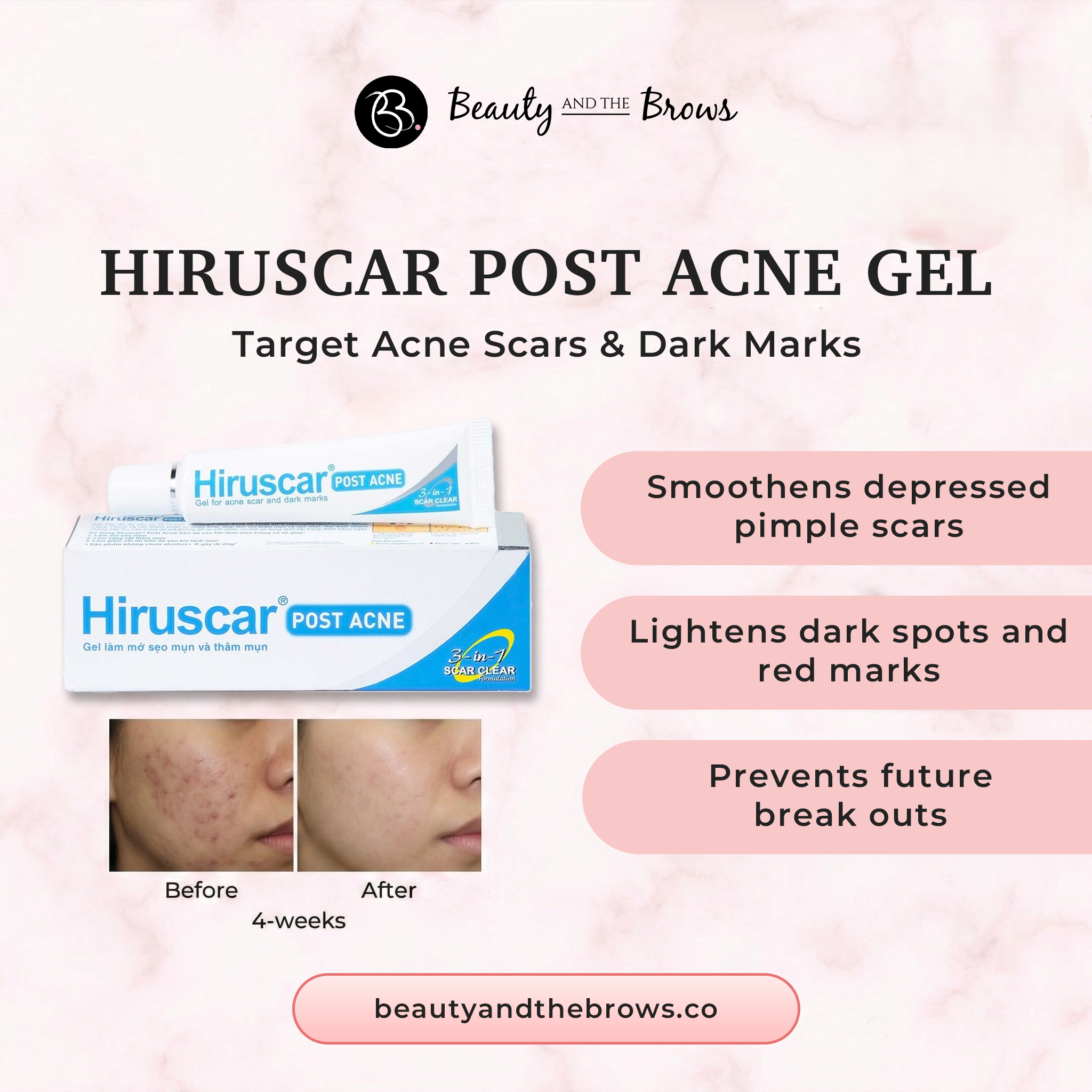HIRUSCAR POST ACNE GEL